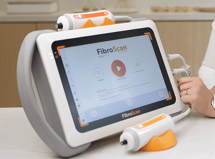 fibroscan1